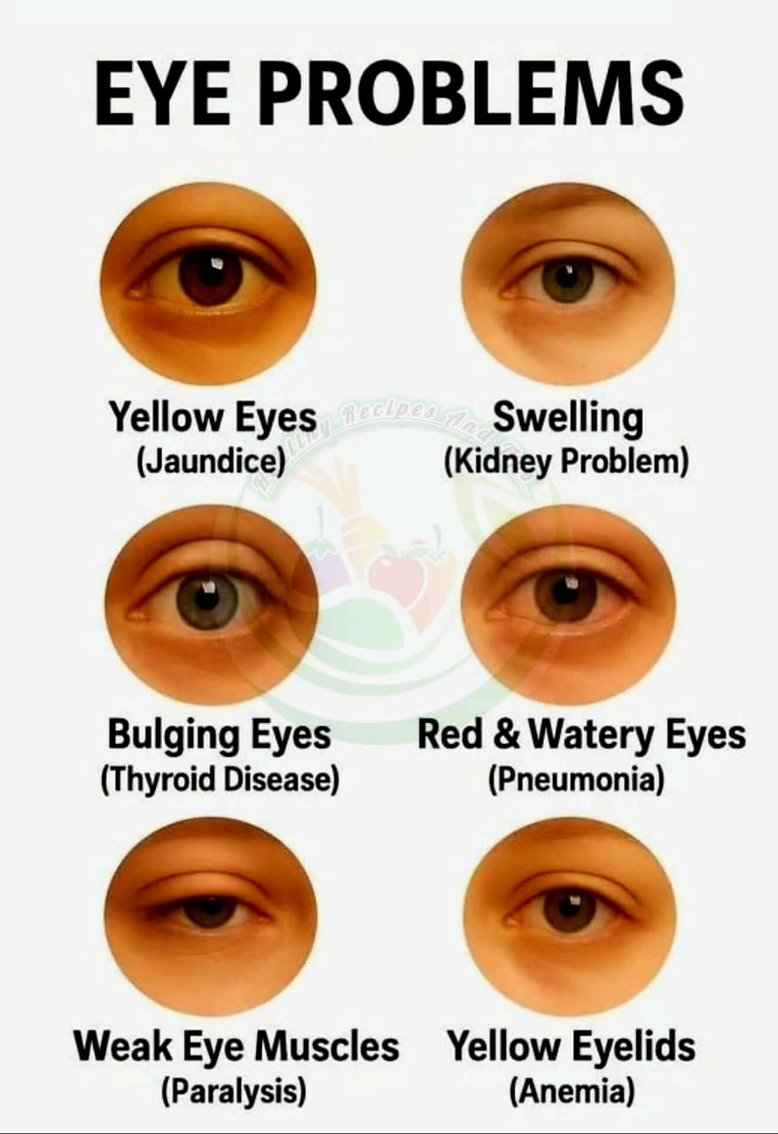 Your Eyes Might Be Warning You!